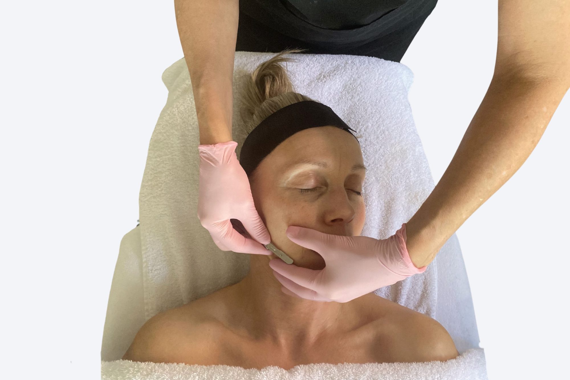 Dermaplaning